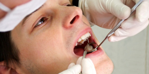 Шесть мифов о кариесе и о здоровье зубов
