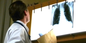 Найден новый способ борьбы с туберкулезом