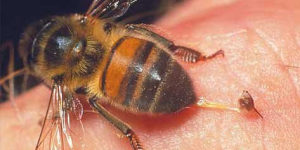 Что делать, если укусила пчела