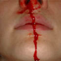 Кровь из носа