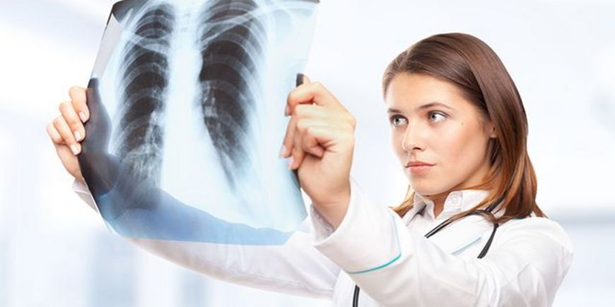 О новых подходах к лечению рака лёгких