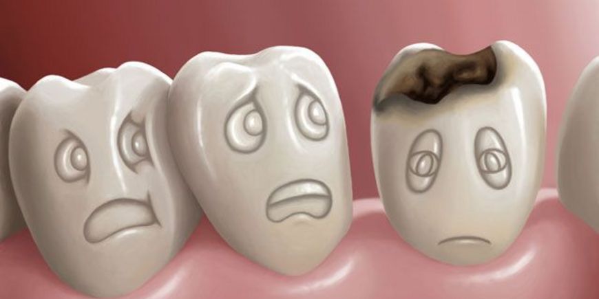 Как защитить зубы от кариеса